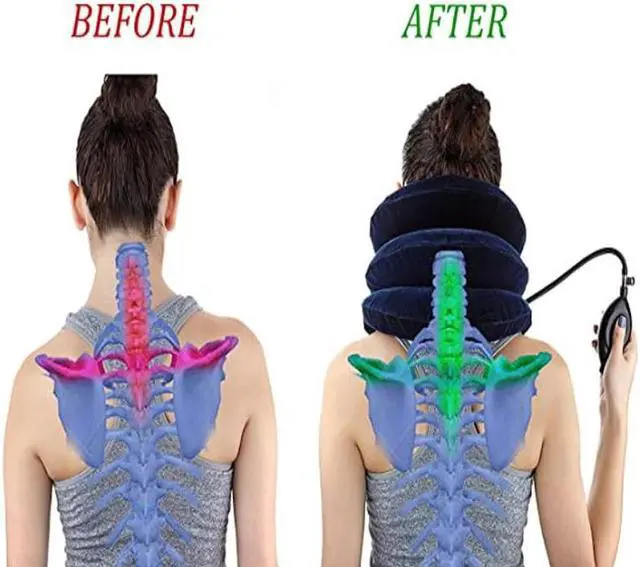 Alt view image 6 of 6 - Cervical Neck Traction Device
