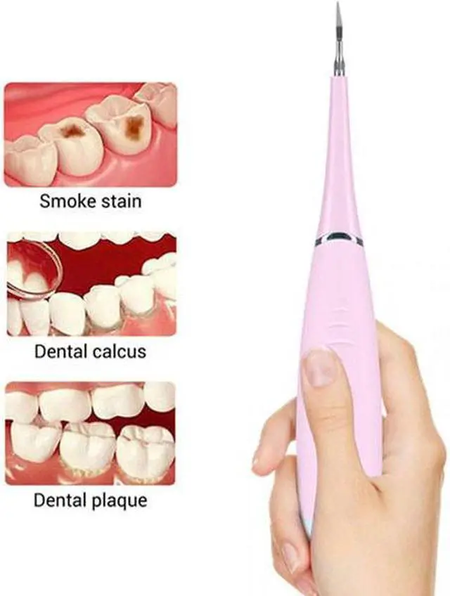 Alt view image 6 of 6 - Electric Sonic Dental Calculus Plaque Remover Tool Kit - Pink - Keep Your Teeth And Gums in Great Shape and Achieve Best Oral Health Care Using This Electric Dental Calculus Remover