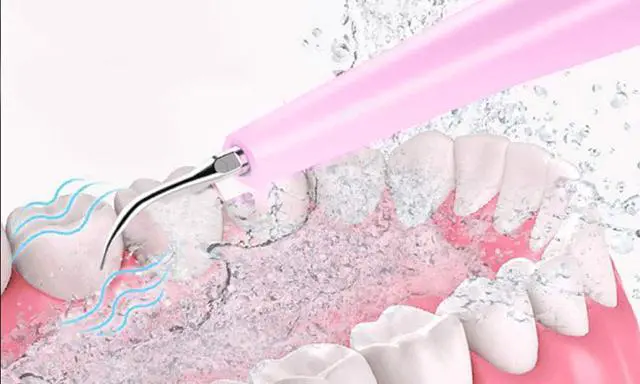 Alt view image 4 of 6 - Electric Sonic Dental Calculus Plaque Remover Tool Kit - Pink - Keep Your Teeth And Gums in Great Shape and Achieve Best Oral Health Care Using This Electric Dental Calculus Remover