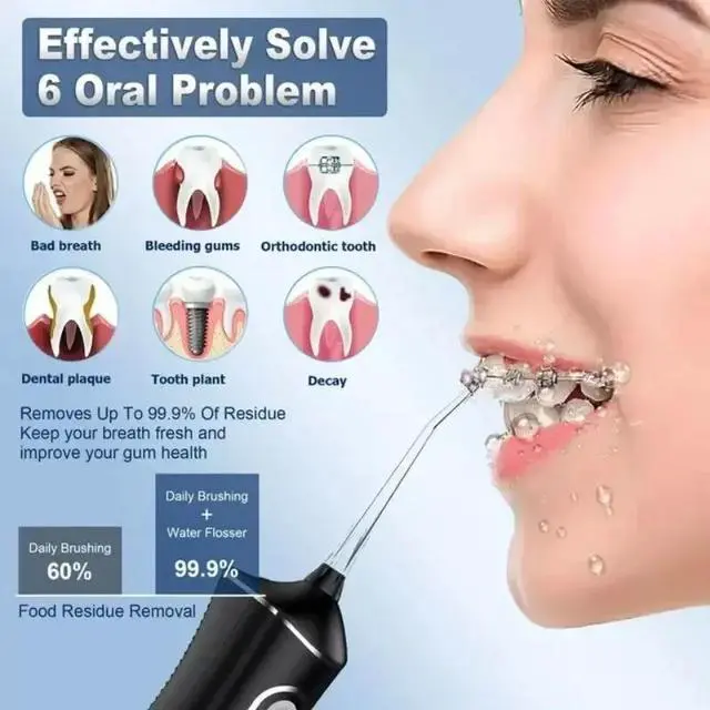 Alt view image 6 of 7 - 310ML Cordless Water Flosser Dental Oral Irrigator Travel Teeth Cleaner Black US