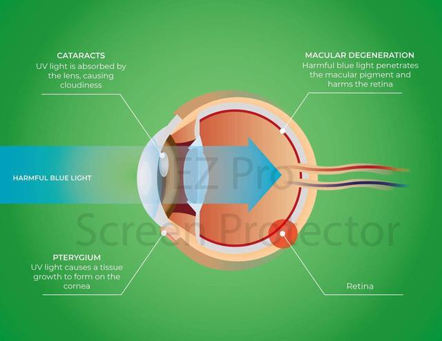 Alt view image 5 of 7 - Anti Blue Light Screen Filter for 23 Inches Widescreen Desktop Monitor, Blocks Excessive Harmful Blue Light, Reduce Eye Fatigue and Eye Strain