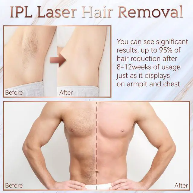 Alt view image 4 of 7 - Laser Hair Removal, IPL Permanent Hair Removal for Women 999900 Flashes 9 Energy Levels Body Hair Removal Device