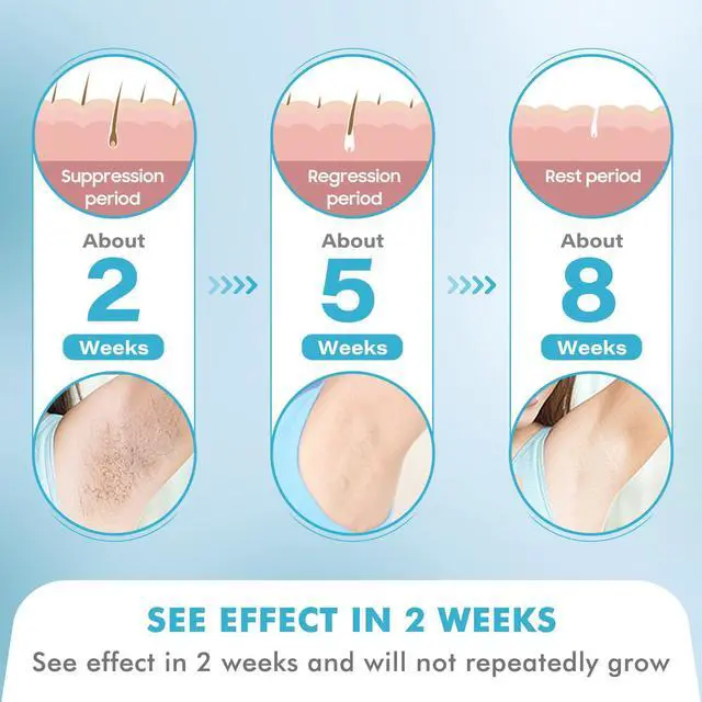 Alt view image 2 of 7 - At-Home Ice Laser Hair Removal for Women and Men, IPL Hair Removal Painless Permanent Device with Rapid Cooling, Hair Removal Safe and Long-lasting for Reducing In Hair Growth for Body & Face