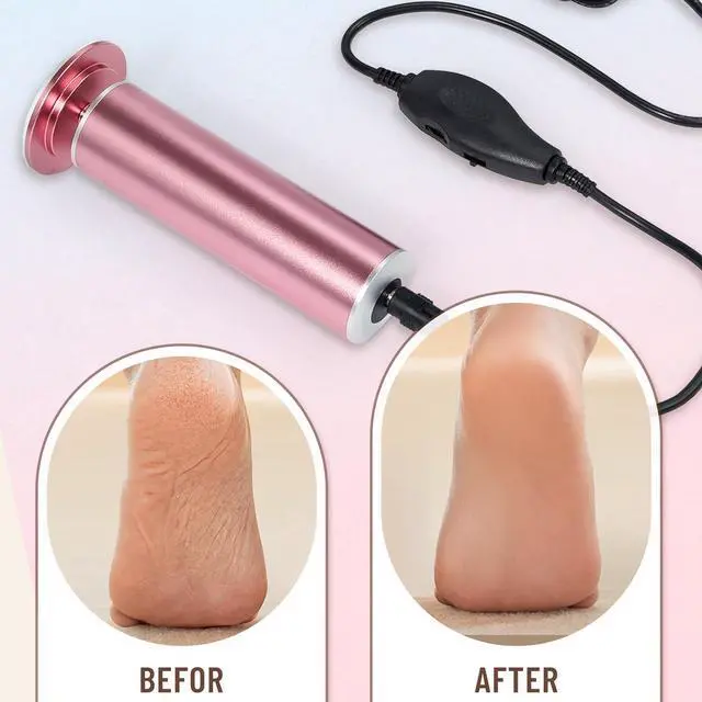 Alt view image 3 of 6 - Electric foot file to remove foot calluses remover with 60 replaceable sandpaper discs, unisex foot grinding foot tool