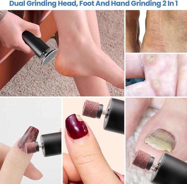 Alt view image 2 of 7 - Electric Foot Callus Remover, Electric Foot File Nail Grinder 2 in 1, Rechargeable Professional Foot Grinder Tool for Dry Dead Skin on Feet with Sandpaper Disc, 6 Speed Adjustable