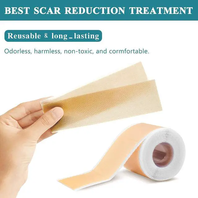 Alt view image 5 of 7 - Silicone Scar Sheets, Professional Silicone Scar Sheets,Scar Silicone Tape Strips, Scar Removal Sheets for C-Section,Surgery,Burn,Keloid,Acne (1.5 Meters(4 Month Supply)