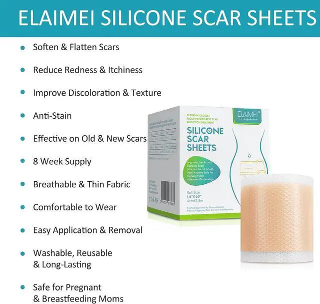 Alt view image 6 of 7 - Silicone Scar Sheets, Professional Silicone Scar Sheets,Scar Silicone Tape Strips, Scar Removal Sheets for C-Section,Surgery,Burn,Keloid,Acne (1.5 Meters(4 Month Supply)