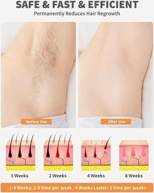 Alt view image 5 of 7 - BONAEVER Home Laser Hair Removal for Women Permanent Painless IPL Hair Removal Device Hair Remover with 9 Energy Levels 2 Flash Modes 999999 Flashes for Armpits