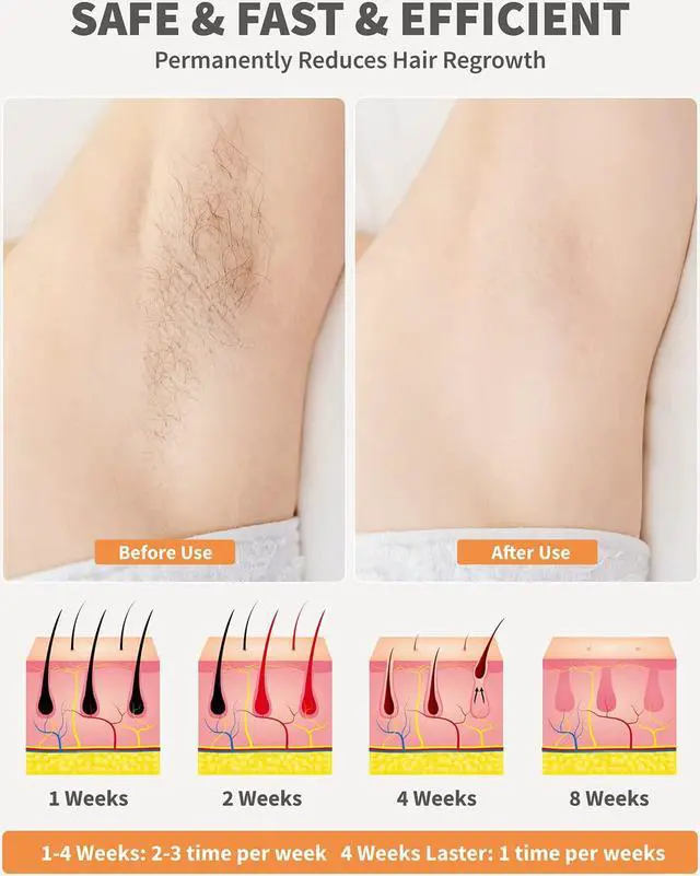 Alt view image 5 of 7 - BONAEVER Home Laser Hair Removal for Women Permanent Painless IPL Hair Removal Device Hair Remover with 9 Energy Levels 2 Flash Modes 999999 Flashes for Armpits Legs Whole Body Use