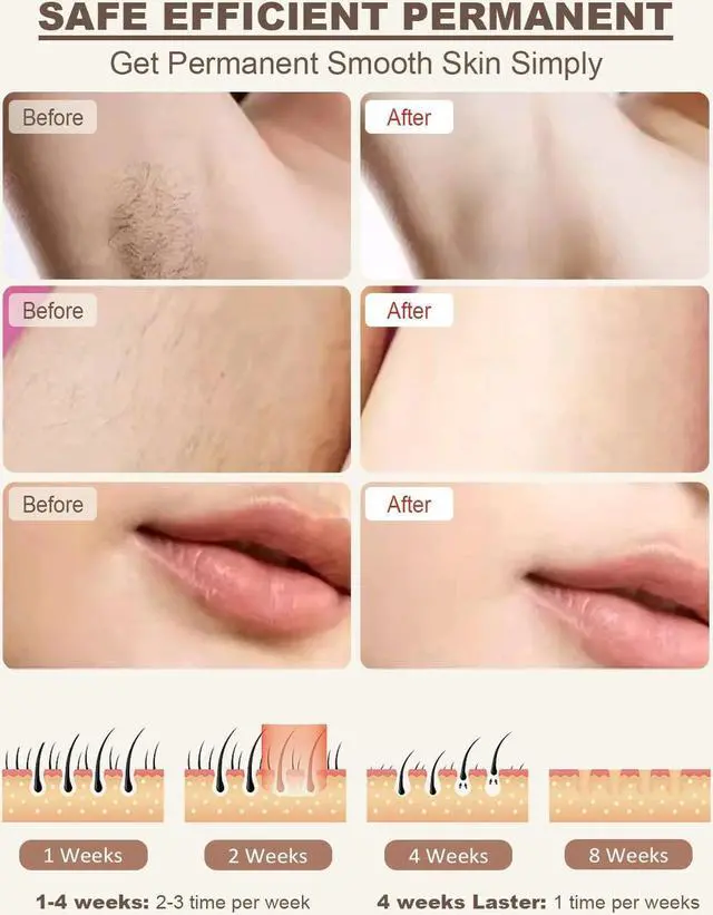 Alt view image 5 of 7 - BONAEVER Laser Hair Removal for Women Permanent Painless at-Home IPL Hair Removal Device Upgraded to 999999 Flashes 5 Level Energy Adjustable & 6 Flash Modes for Beautify Skin Face Body Bikini