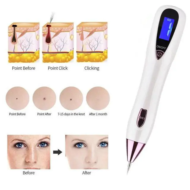 Alt view image 5 of 7 - Anti-Aging Laser Plasma Pen Mole Removal Dark Spot Skin Tag Tattoo Wart Remover