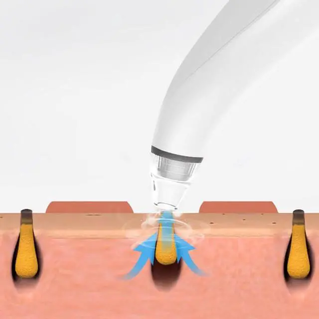 Alt view image 3 of 7 - Electric Blackhead Remover Cleaner Face Diamond Pore Vacuum Suction White Heads