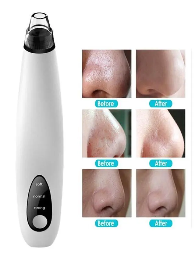 Alt view image 4 of 7 - Electric Blackhead Remover Cleaner Face Diamond Pore Vacuum Suction White Heads