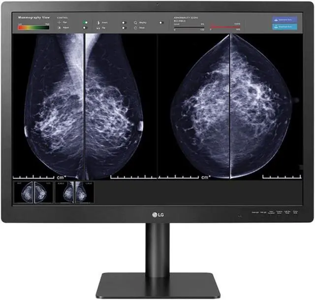 Alt view image 3 of 10 - LG 31in MEDICAL ANTI-GLARE, 3H DIGNOSTIC MONITOR 4200 X 2800 (3:2) CLASS II FDA 510K