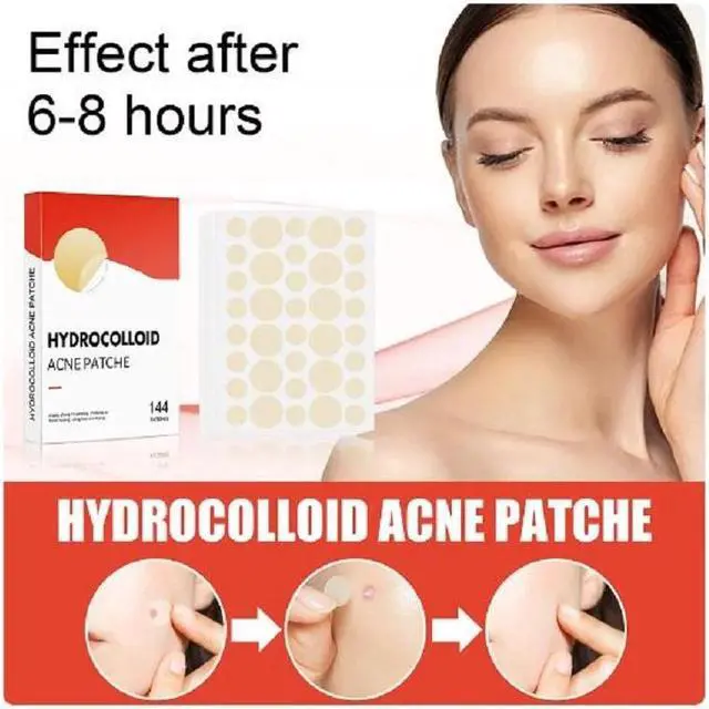 Alt view image 5 of 6 - Acne Patches Hydrocolloid Acne Pimple Patch 144 Count Spot Stickers for Face