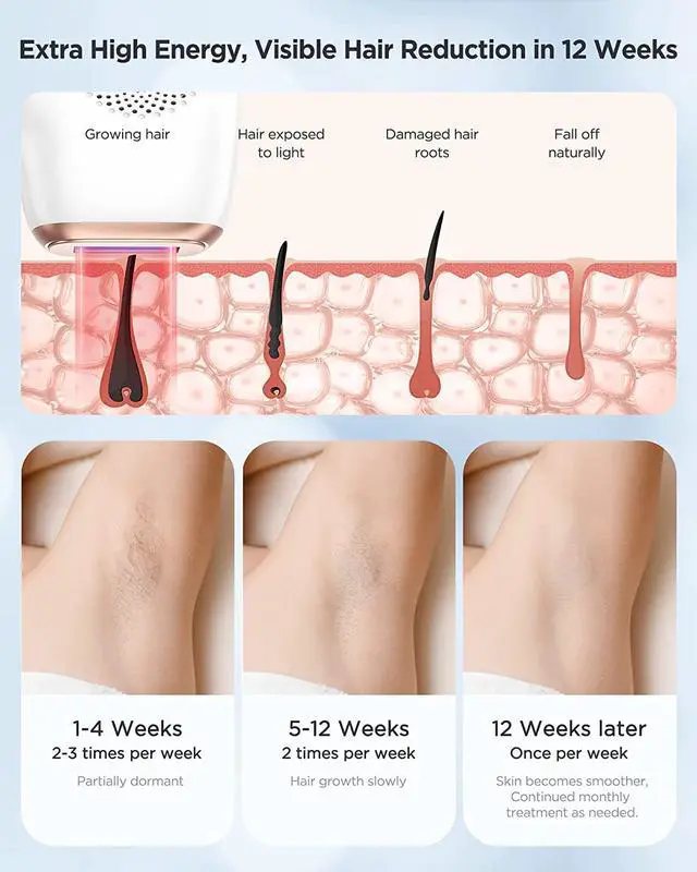 Alt view image 6 of 7 - At-Home IPL Hair Removal for Women and Men, Permanent Laser Hair Removal 999999 Flashes for Facial Legs Arms Whole Body Treatment