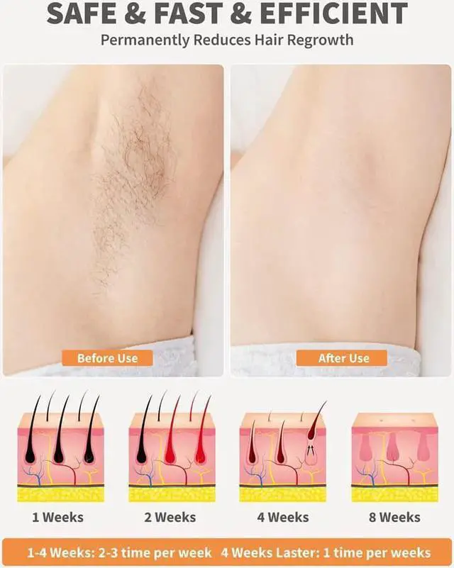 Alt view image 6 of 7 - IPL Permanent Hair Removal Machine 5 Levels Body Removal Device Auto and Manual Facial Body Hair Trimmer Electric Hair Epilator Machine for Women Girls Home Travel