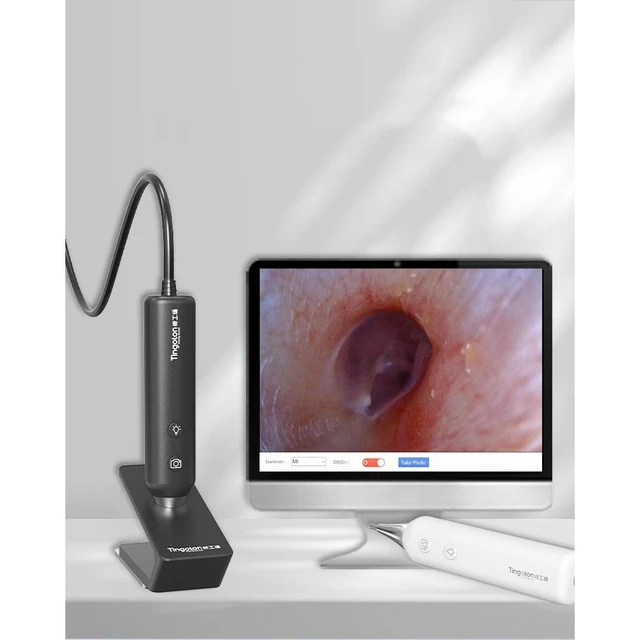 Alt view image 6 of 7 - GANGXUN Smart Otoscope, Digital Otology Inspection Camera 1280x720, USB Ear Scope with LED for Hearing Aid Fitting, Windows & Mac