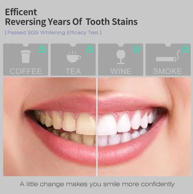 Alt view image 5 of 5 - KAVVO Shell Teeth Whitening Kit with Automatic UV Disinfection Function, Dust-Proof, 450mAh Rechargeable Battery, 14-Time Runtime, Extra Teeth Tray & Gel Tubes for a Brighter Smile
