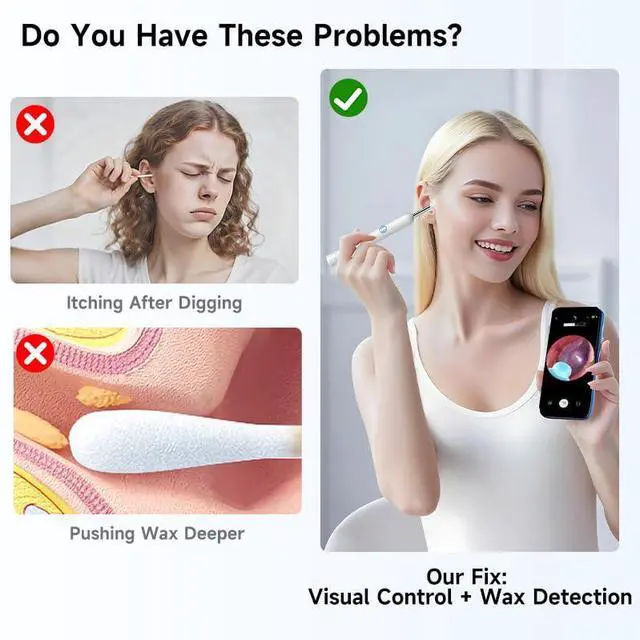 Alt view image 2 of 6 - KEHIPI Ear Wax Removal Tool Camera, Otoscope with 8 Pcs Ear Set, Digital Visual Ear Pick Wax Remover, Ear Cleaning Kit with 6 Ear Spoon for iOS & Android-White