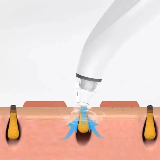 Alt view image 5 of 7 - Electric Blackhead Remover Cleaner Face Diamond Pore Vacuum Suction White Heads