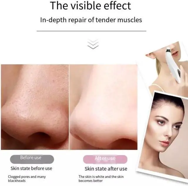 Alt view image 2 of 7 - Electric Blackhead Remover Cleaner Face Diamond Pore Vacuum Suction White Heads