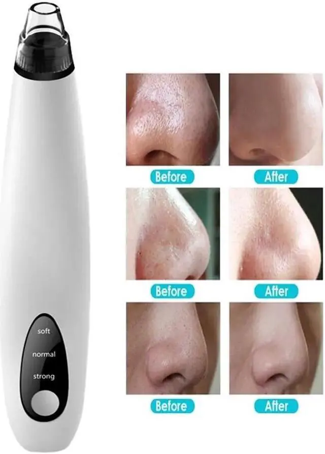 Main image of Electric Blackhead Remover Cleaner Face Diamond Pore Vacuum Suction White Heads