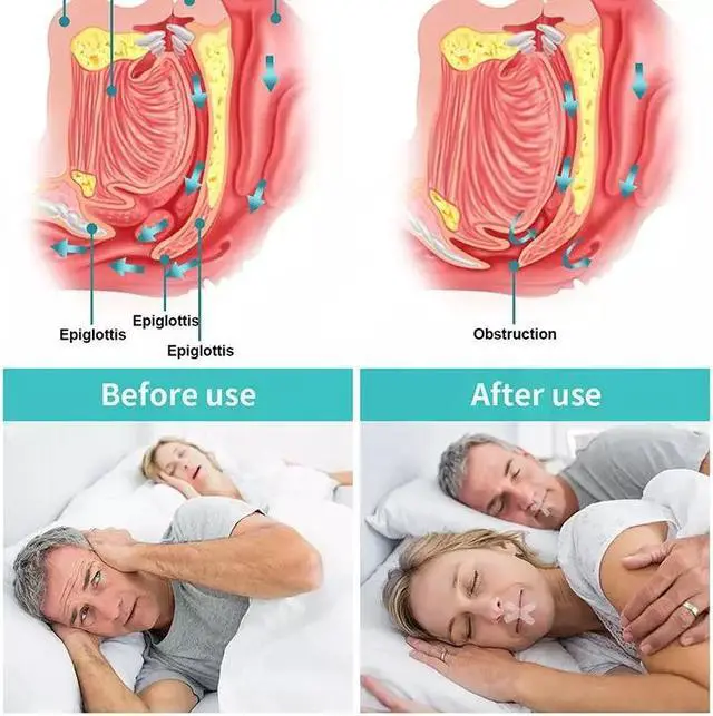 Alt view image 4 of 7 - 90PCS Gentle Mouth Tape Anti Snoring Seal Hypoallergenic Strips Stop Snoring