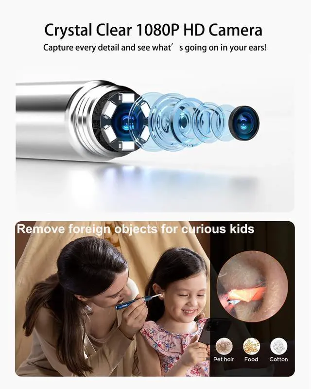 Alt view image 3 of 7 - Note5 Ear Wax Removal Tool Camera Tweezers, Ear Cleaner Scope Otoscope with Camera & Light, Wireless Earwax Remover Visual Ear Picker, Video Ear Cleaning Kit for iPhone,Android(Blue)