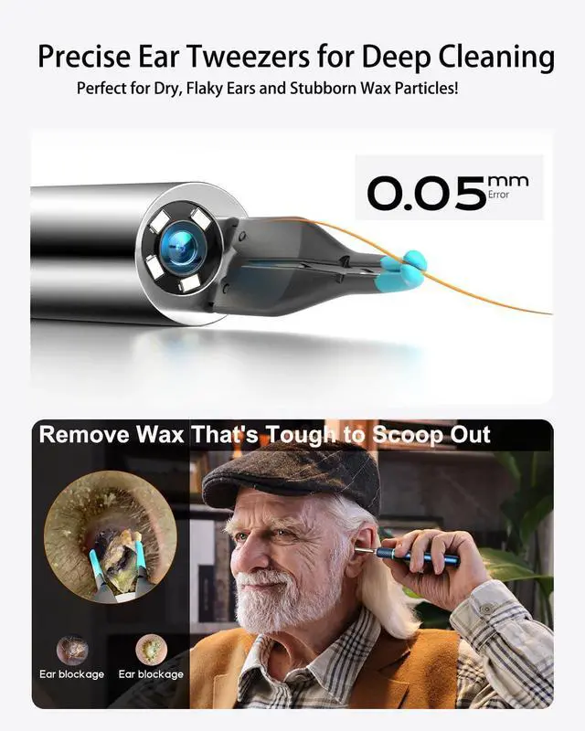 Alt view image 4 of 7 - Note5 Ear Wax Removal Tool Camera Tweezers, Ear Cleaner Scope Otoscope with Camera & Light, Wireless Earwax Remover Visual Ear Picker, Video Ear Cleaning Kit for iPhone,Android(Blue)