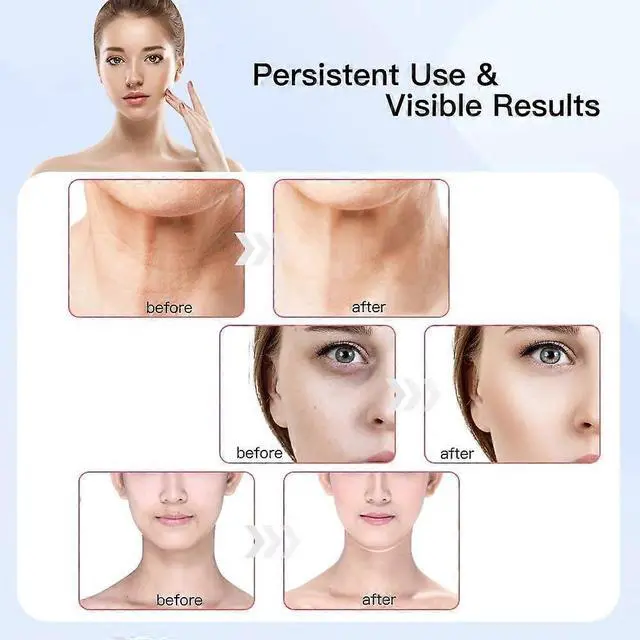 Alt view image 4 of 5 - Ecocleanpath White & Silver Facial Massager with Heat & Vibration for Skin Care & Double Chin Reduction