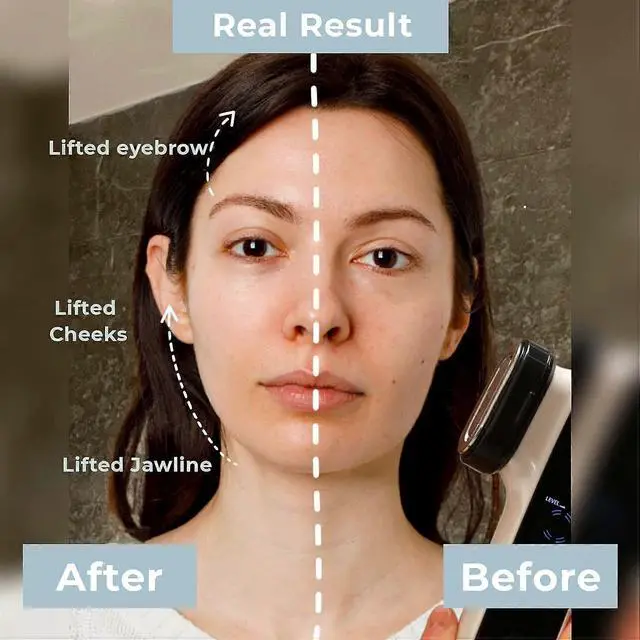 Alt view image 5 of 5 - Ecocleanpath 6-in-1 Skin Tightening Machine with Red Light Therapy - Wrinkle Removal & Rejuvenation, White