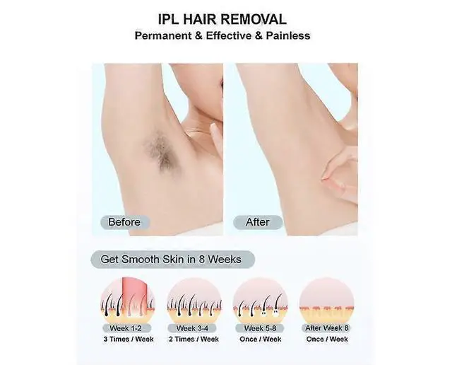 Alt view image 2 of 5 - Ecocleanpath At-Home IPL Hair Removal Device, 999,999 Flashes Painless Permanent Hair Removal for Women & Men, Full Body Use - White