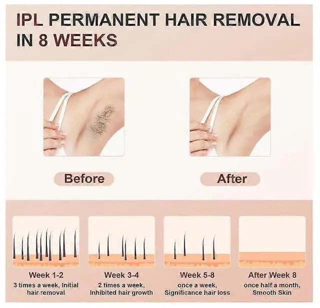 Alt view image 2 of 5 - Ecocleanpath At-Home IPL Hair Removal Device for Women & Men - Painless Permanent Hair Removal for Face, Body, Bikini Line