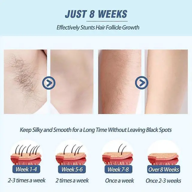 Alt view image 3 of 5 - Ecocleanpath Painless IPL Hair Removal Device for Women - 5 Levels, Face & Body Use, Permanent Results at Home