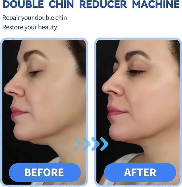 Alt view image 2 of 5 - Ecocleanpath Electric V-Face Massager: 6 Modes, 12 Gears for Double Chin Reduction & Facial Contouring