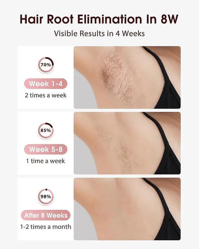 Alt view image 3 of 5 - Ecocleanpath 3-in-1 IPL Laser Hair Removal with Cooling - 9 Levels, Painless Device for Women & Men, Full Body Home Use - White