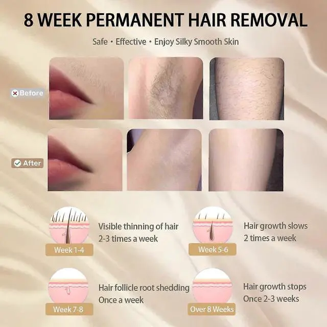 Alt view image 4 of 5 - Ecocleanpath IPL Laser Hair Removal Device with Ice Cooling, 999,999 Flashes & 5 Levels for Painless At-Home Use