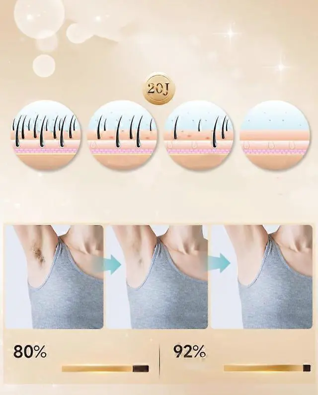 Alt view image 3 of 5 - Ecocleanpath Salon Grade IPL Hair Remover, 20J, 1M Shots, 5 Levels, VIO Compatible, Painless & Cool