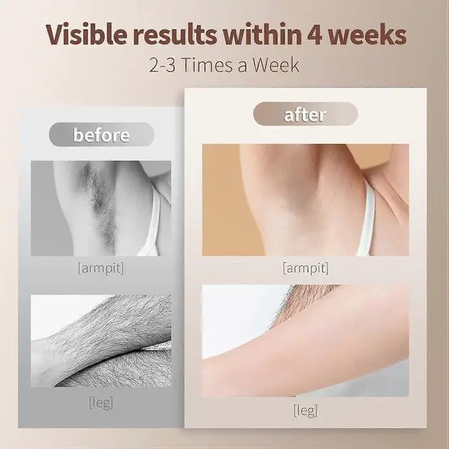 Alt view image 4 of 5 - Ecocleanpath Advanced IPL Laser Hair Removal System - 5 Intensity Settings, Goggles & Shaver, White