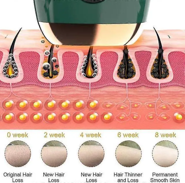 Alt view image 2 of 5 - Ecocleanpath Laser Painless IPL Hair Removal Device, 5 Intensity Levels & 2 Modes for Permanent Smooth Skin