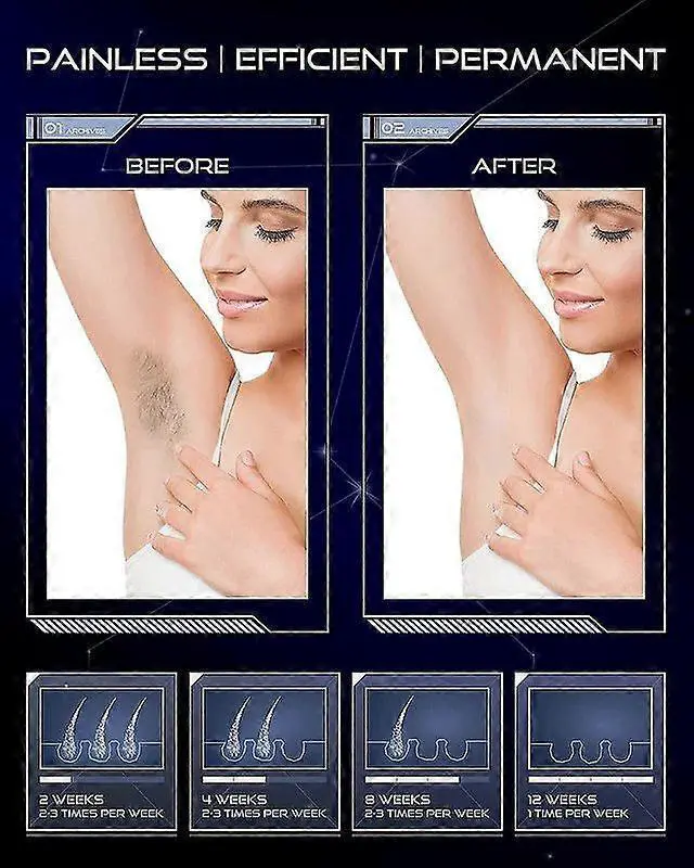 Alt view image 3 of 5 - Ecocleanpath T130726H1 Professional IPL Hair Removal Device - Painless At-Home Laser Epilator for Women & Men