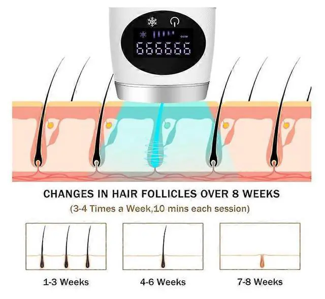 Alt view image 5 of 5 - Ecocleanpath IPL Hair Removal Device with Cooling System, 5 Energy Levels & 999K Pulses for Women - Pink