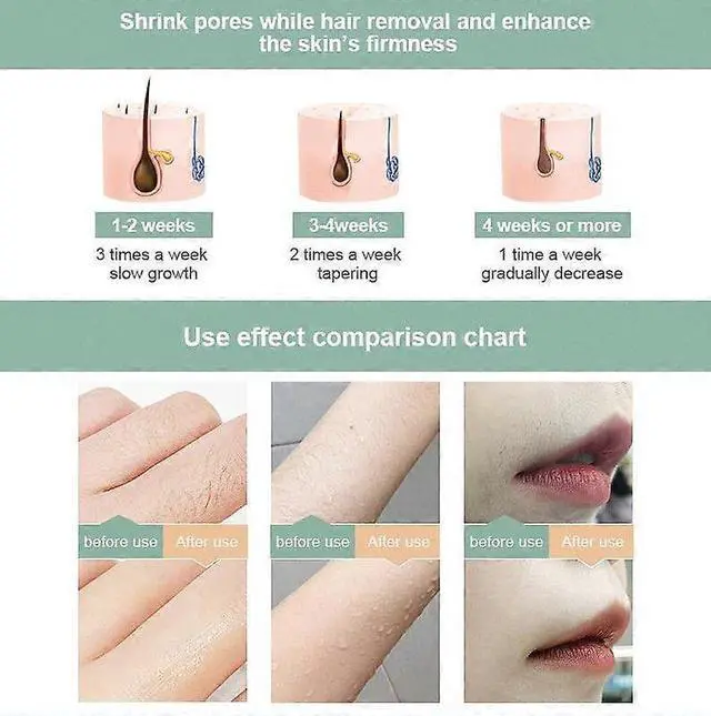 Alt view image 4 of 5 - Ecocleanpath IPL Laser Hair Removal Device for Women & Men, 5 Levels, 999,900 Flashes, LCD Screen