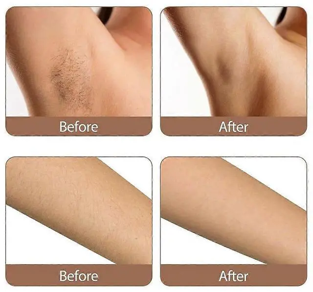 Alt view image 3 of 5 - Ecocleanpath Painless IPL Hair Removal Device with Ice Cooling, 999,999 Flashes for Women - At-Home Permanent Hair Removal (White)