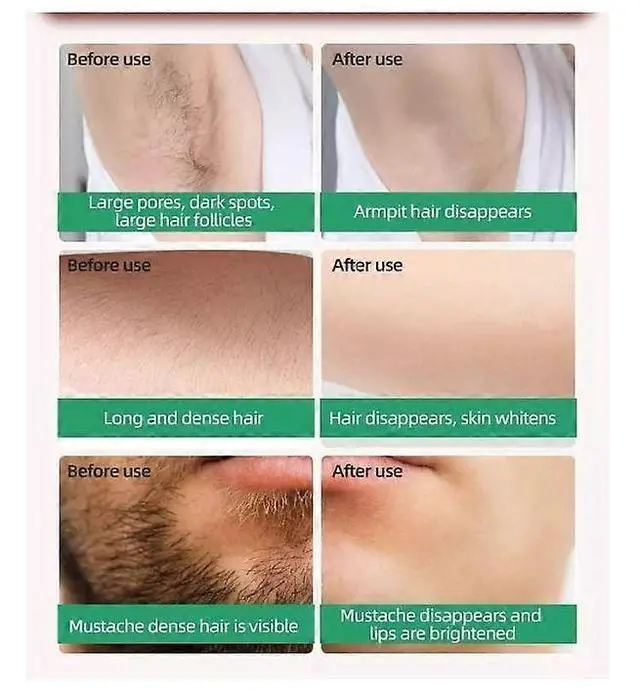 Alt view image 5 of 5 - Ecocleanpath At-Home IPL Hair Removal Device for Women, Painless Permanent Laser Hair Removal, 999,999 Flashes, 5 Energy Levels (Green)