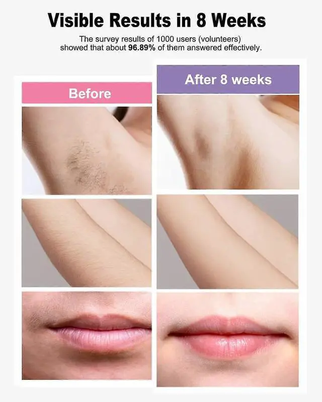 Alt view image 3 of 5 - Ecocleanpath Purple IPL Laser Hair Removal Device, 999,999 Flashes, 5 Levels, Safe & Effective for Women & Men