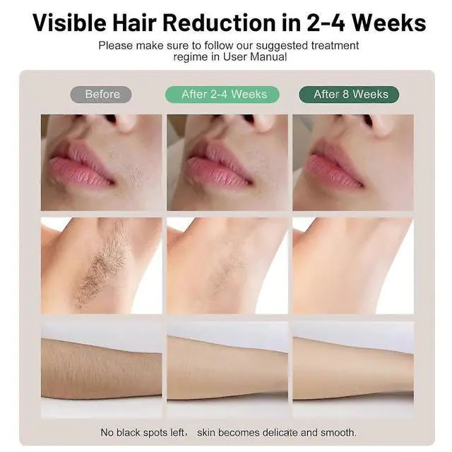 Alt view image 4 of 5 - Ecocleanpath Green IPL Laser Hair Removal Device with Cooling Function, 5 Levels, 1M+ Flashes for At-Home Use