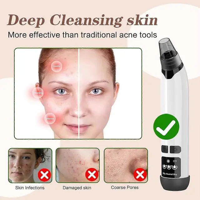 Alt view image 3 of 5 - Ecocleanpath Electric Blackhead Remover Vacuum with Heating & 4 Suction Modes, USB Rechargeable Facial Pore Cleaner Tool