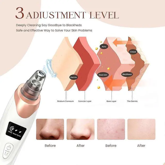Alt view image 3 of 5 - Ecocleanpath 2024 USB Rechargeable Blackhead Remover Vacuum: 5 Suction Levels, 5 Probes, Deep Pore Cleaner for Acne & Blackheads